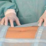 Комплект общехирургический КООП-02 ГЕКСА одноразовый стерильный 6 предметов, ш/к 44253