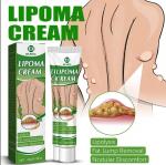 Крем Lipoma для удаления опухолей, средство для удаления отеков кожи, нодулярного дискомфорта, лечения липолиза, крем для удаления жира