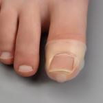 Защитные чехлы для коррекции вросших ногтей, пара, 2,8 х 2 см, цвет бежевый
