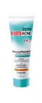 ACNE МикроПилинг д/лица очищающий 75мл/20