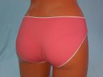 Трусы женские