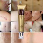 Гель от шрамов и растяжек LANBENA Scar Acne Removal Gel, 30 мл