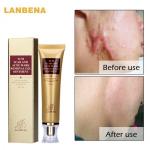 Гель от шрамов и растяжек LANBENA Scar Acne Removal Gel, 30 мл