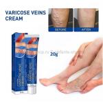 крем для ухода за венами ног JAYSUING Varicose Veins Cream 20 g (106)