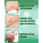 Пластыри от прыщей Lanbena Acne Pimple Patch 28 пластырей (37)